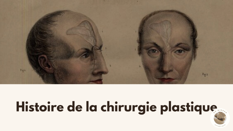 histoire-de-la-chirurgie-plastique