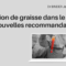 injection-graisse-dans-les-seins-recommandations-dr-binder-blog