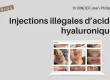 Injections illégales d’acide hyaluronique