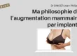 Ma philosophie de l’augmentation mammaire par implants