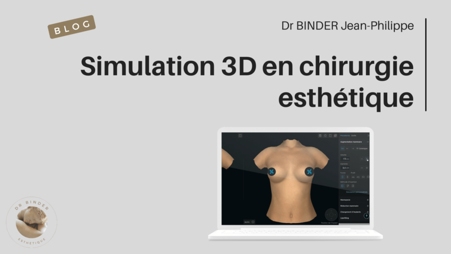 simulation-3D-chirurgie-esthétique-blog