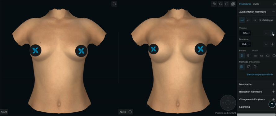 simulation-3D-simulation-patient-dr-binder