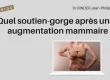 Soutien-gorge de contention après une augmentation mammaire