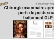 Chirurgie mammaire après perte de poids GLP-1 – Dr Binder, Paris