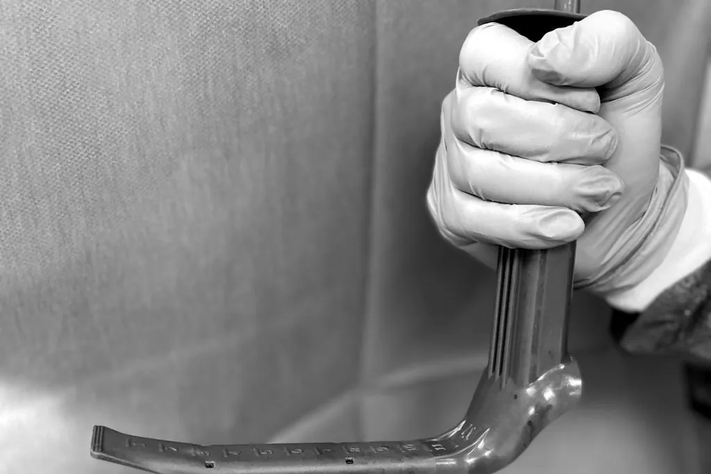 Écarteur chirurgical utilisé pour la voie d’abord lors d’une augmentation mammaire par implant