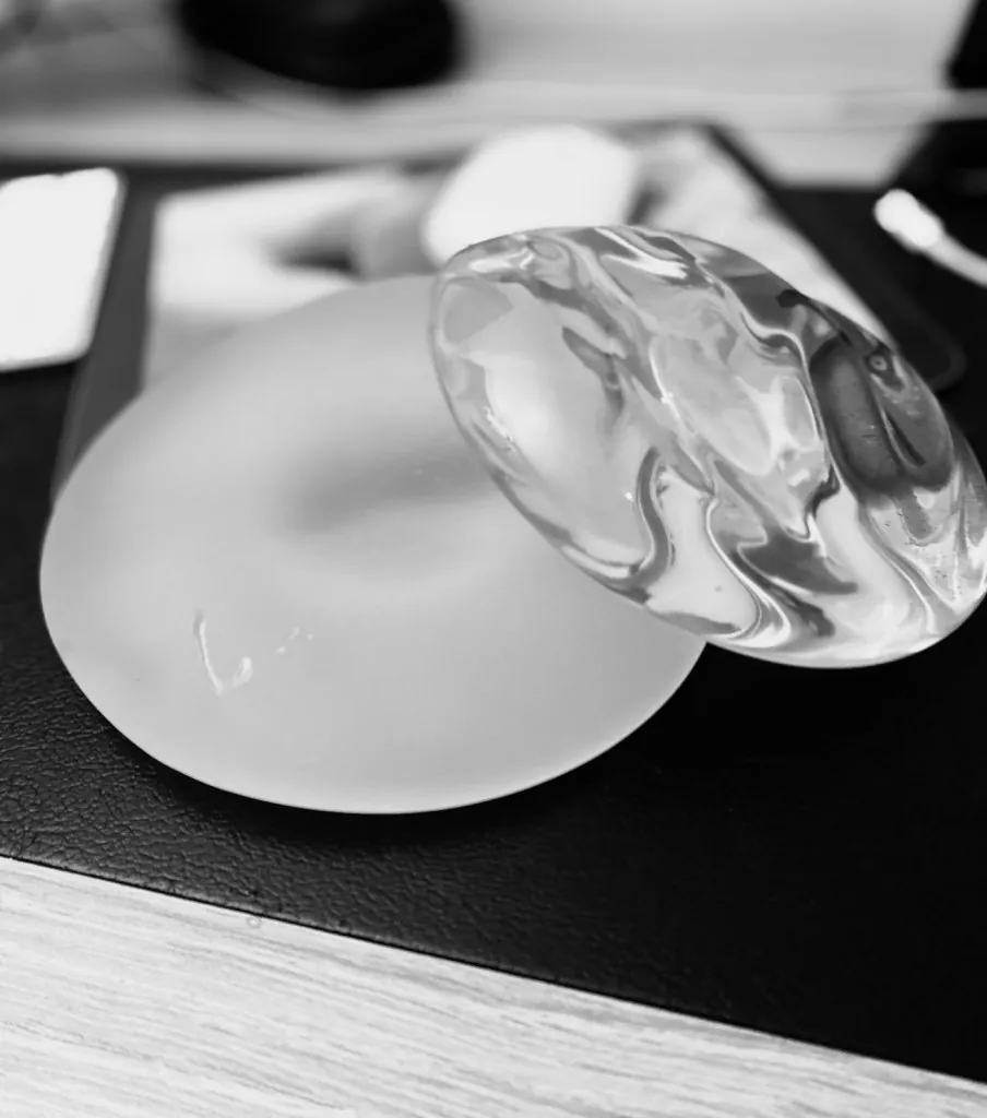 Implant mammaire lisse et gel de silicone cohésif